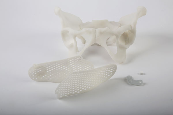 3D-printed-medical-parts